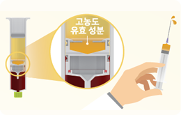 스템 트랩 삽입